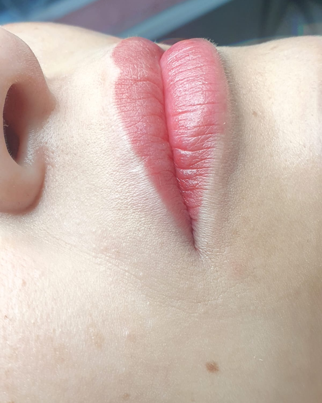 25