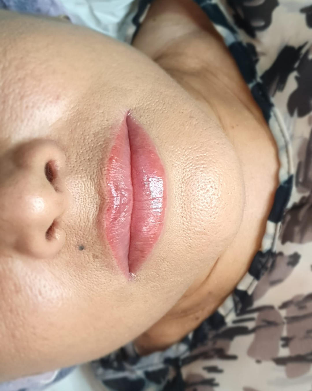 28
